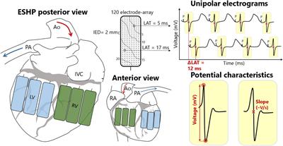 Electrophysiological Markers of Ex-Situ Heart Performance in a Porcine Model of Cardiac Donation After Circulatory Death